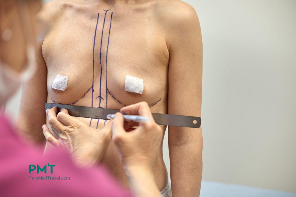 breast augmentation in iran-pmt