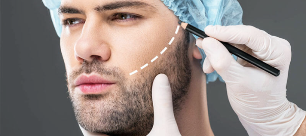 Beard | Best Cost & Surgeons in Iran