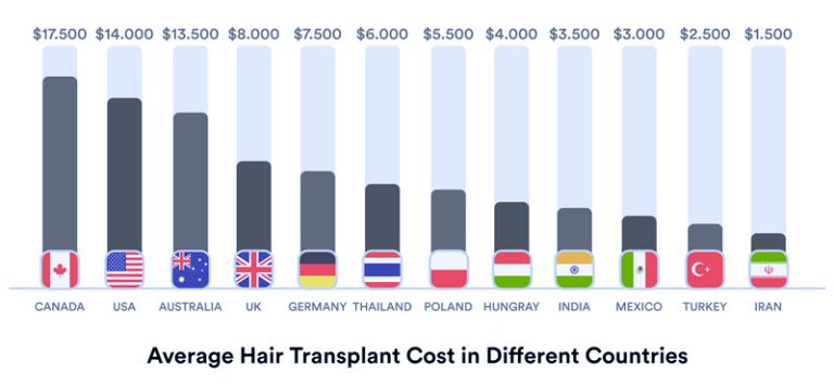 pars-med-travel-average-hair-transplant-cost-in-different-countries