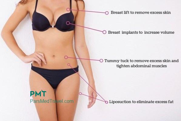 Cosmetic Surgery in Iran-pmt
