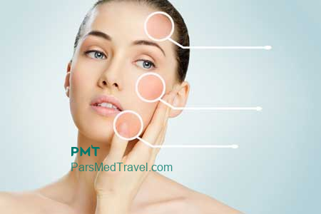 The best Facial skin analysis in Iran-pmt