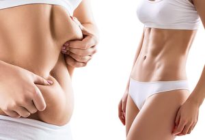 Fix all abdominal beauty problems with one surgery in Iran-pmt