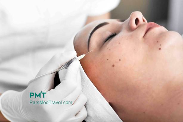 Carboxytherapy in Iran-pmt
