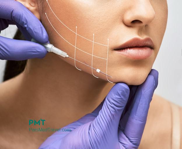 Beauty with thread lift in Iran-pmt