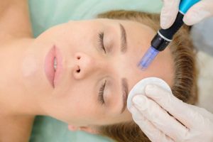 Microneedling and change skin in Iran-pmt