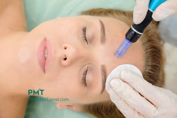 Microneedling and change skin in Iran-pmt