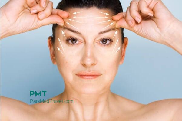 Young and well-shaped face with eyebrow lift-pmt